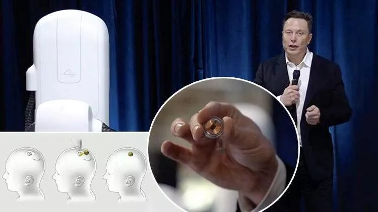 Dünya Elon Musk’ın yeni projesine kilitlendi! Beyne çip yerleştirerek…